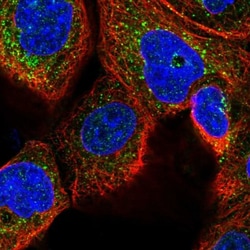 WDTC1 Antibody, Novus Biologicals 0.1mL; Unlabeled:Antibodies, Polyclonal
